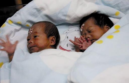 科學治療新生兒黃疸 新生兒出現黃疸學會這樣護理